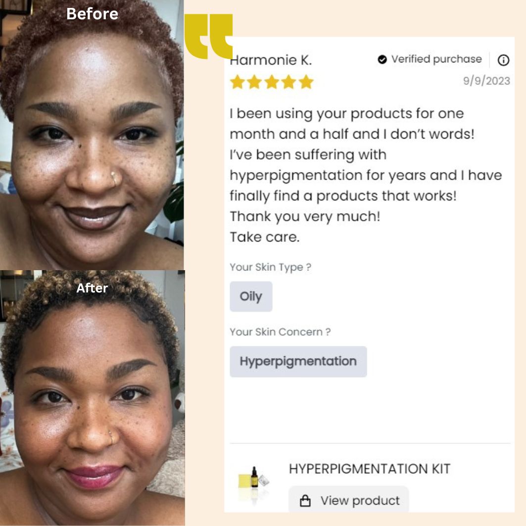 Hyperpigmentation kit