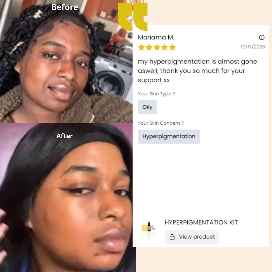 Hyperpigmentation kit