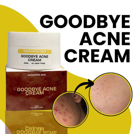 Goodbye Acne Cream