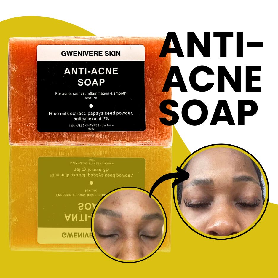 Anti- Acne Soap