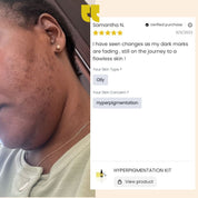 Hyperpigmentation Kit