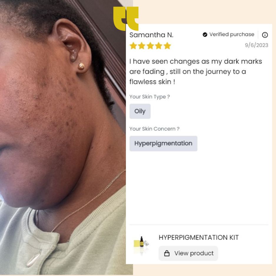 Hyperpigmentation Kit