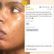 Hyperpigmentation Kit