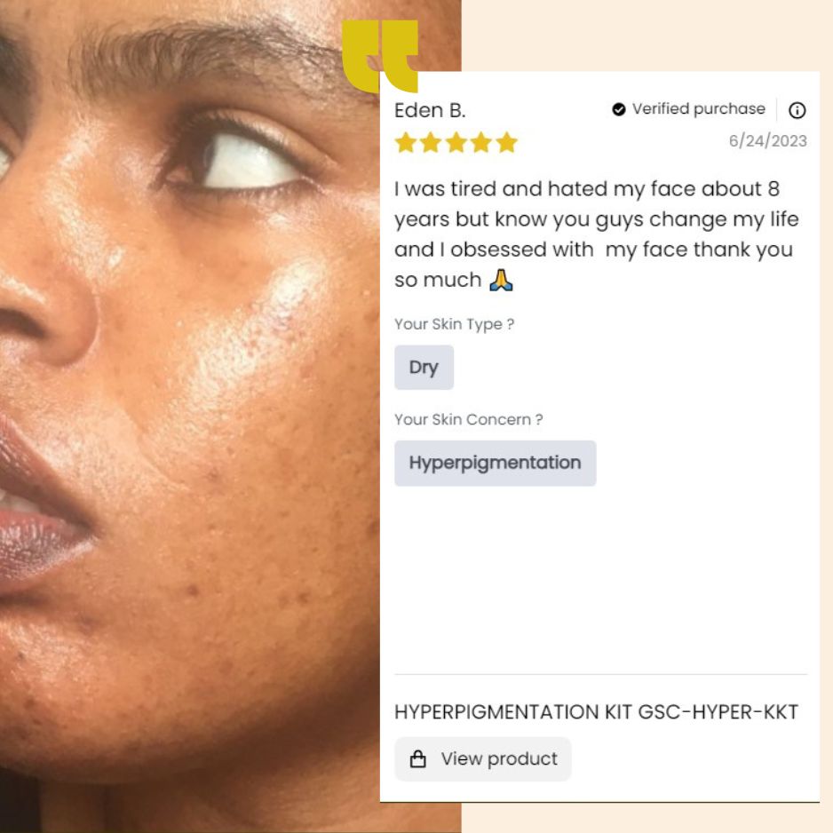 Hyperpigmentation kit