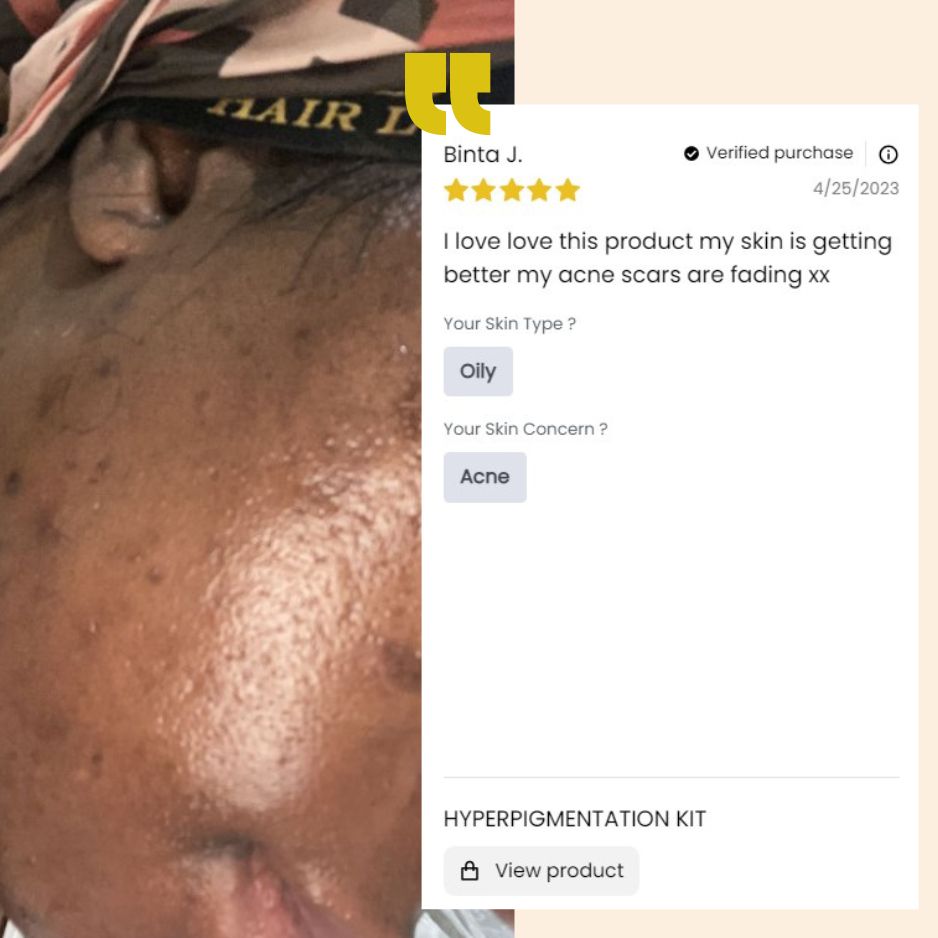 Hyperpigmentation kit