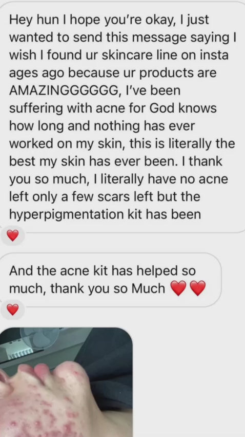 Acne kit – Gwenivere Skin